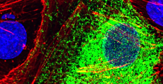 Una inteligencia artificial de Stanford distingue células sanas y enfermas a partir de la actividad de sus genes