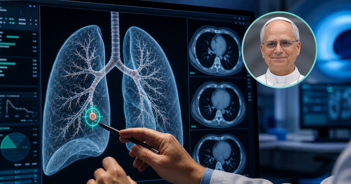 Tres milímetros en el pulmón: por qué los médicos suelen sacarlo igual, aunque parezca tan poco